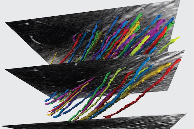 X-ray microtomography